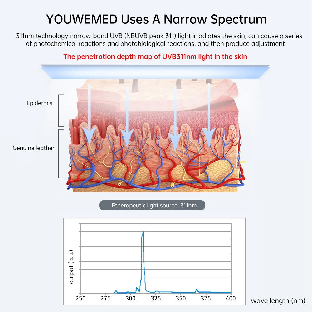 311nm Narrowband UVB Phototherapy Device – Clinical-Grade Home Light Therapy (BU-1S)